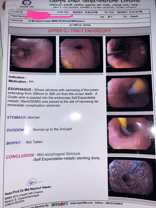 Read more about the article Alhamdulillah, another successful esophageal stenting done under deep sedation.